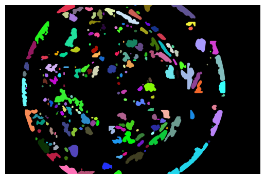 /projects/s2_soft_exudates_detection_in_fundus_images/images/s2_soft_exudates_detection_in_fundus_images_2.png