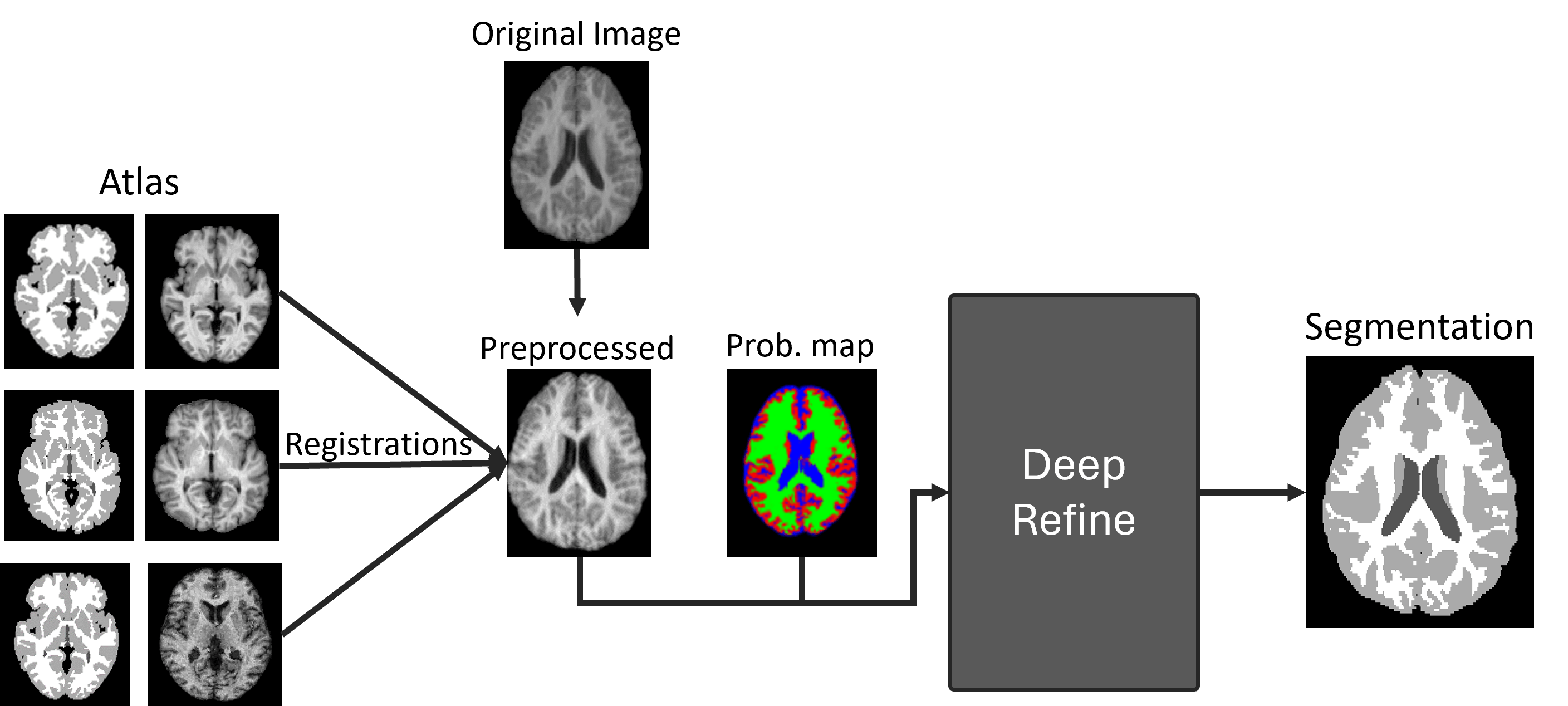 /projects/s3_hybrid_atlas_and_cascade_u-net_brain_tissue_segmentation/images/s3_hybrid_atlas_and_cascade_u-net_brain_tissue_segmentation_1.png