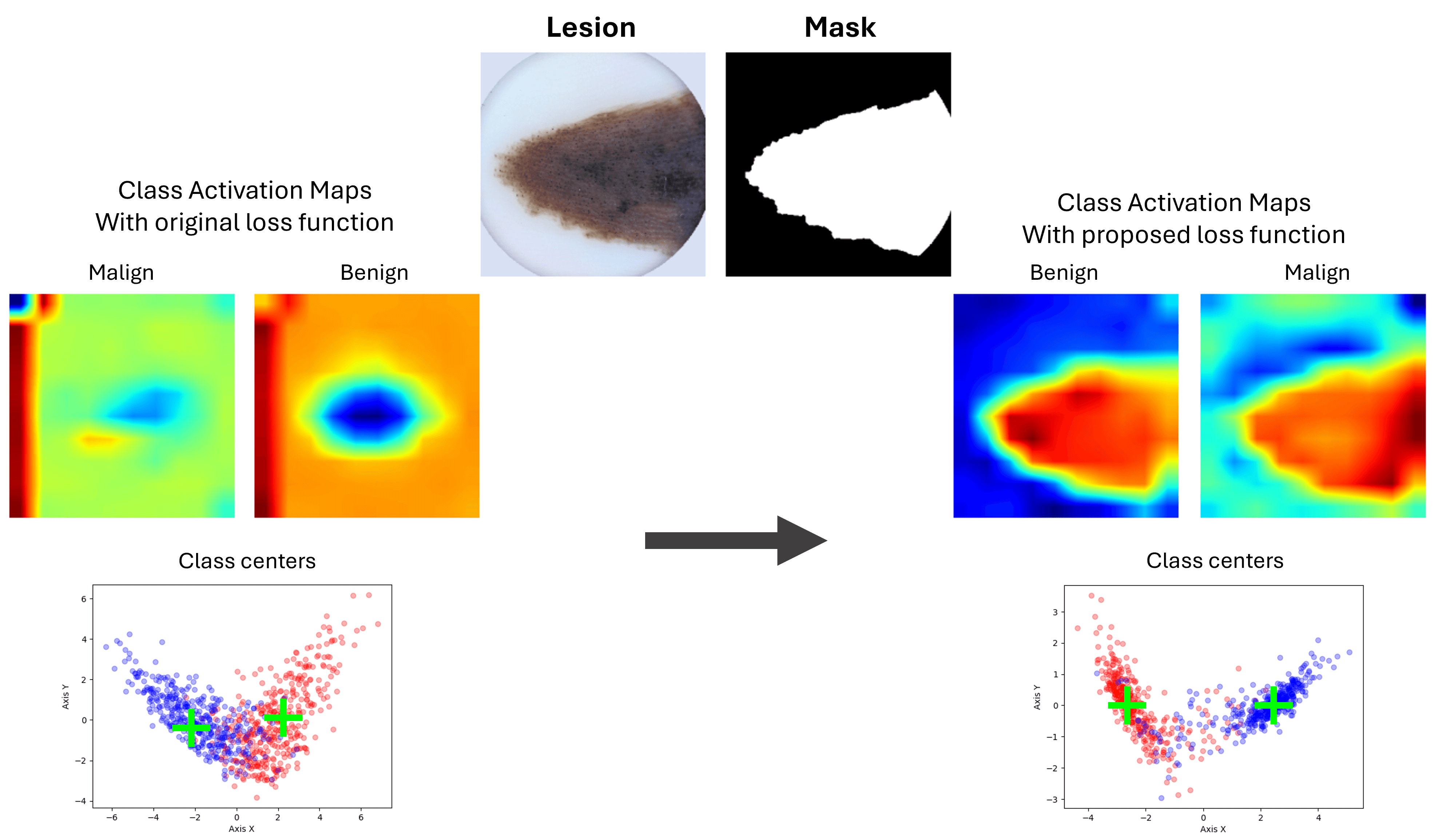 /projects/s3_skin_lesion_detection_dl/images/s3_skin_lesion_detection_dl_1.png