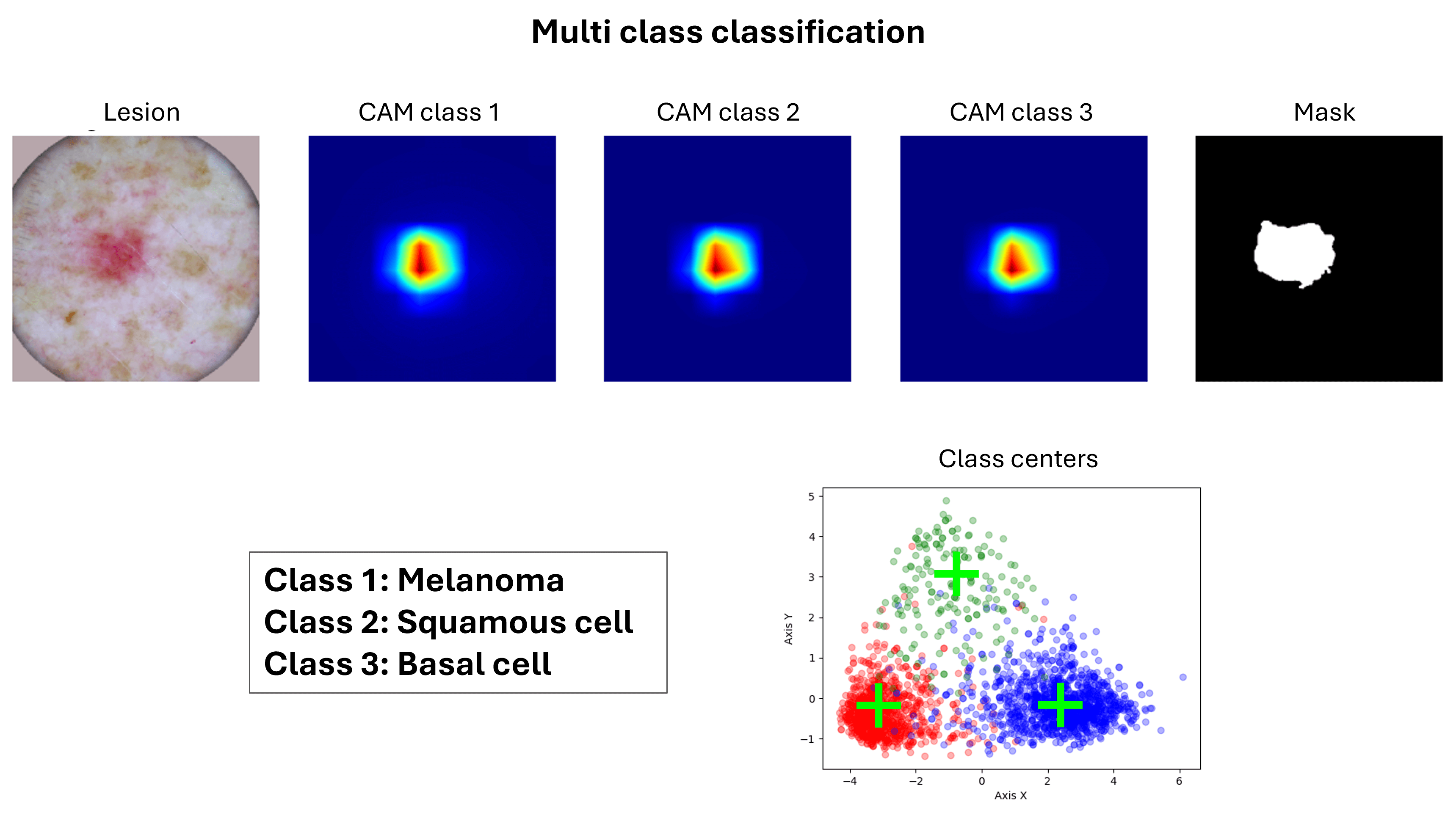 /projects/s3_skin_lesion_detection_dl/images/s3_skin_lesion_detection_dl_2.png