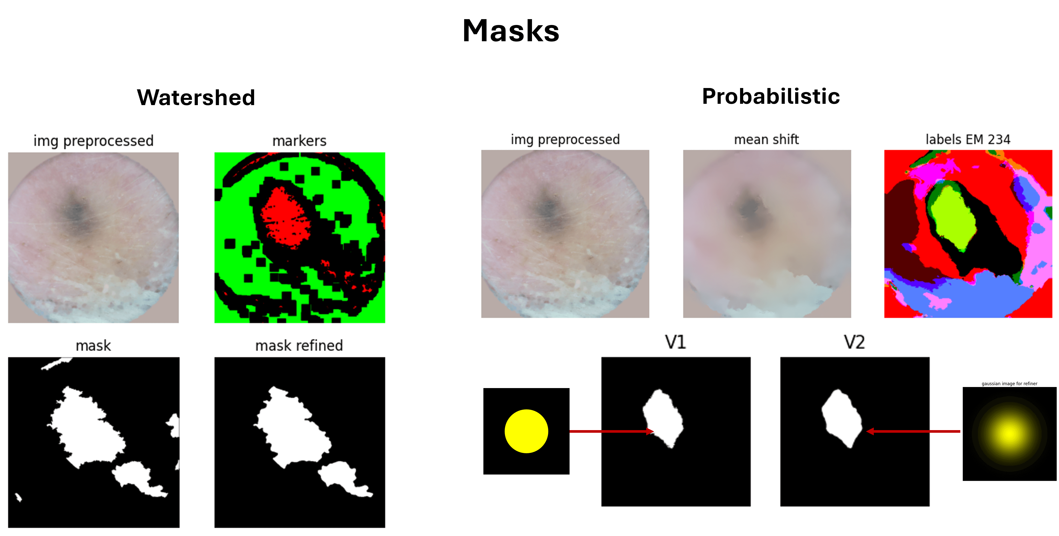 /projects/s3_skin_lesion_detection_ml/images/s3_skin_lesion_detection_ml_2.png