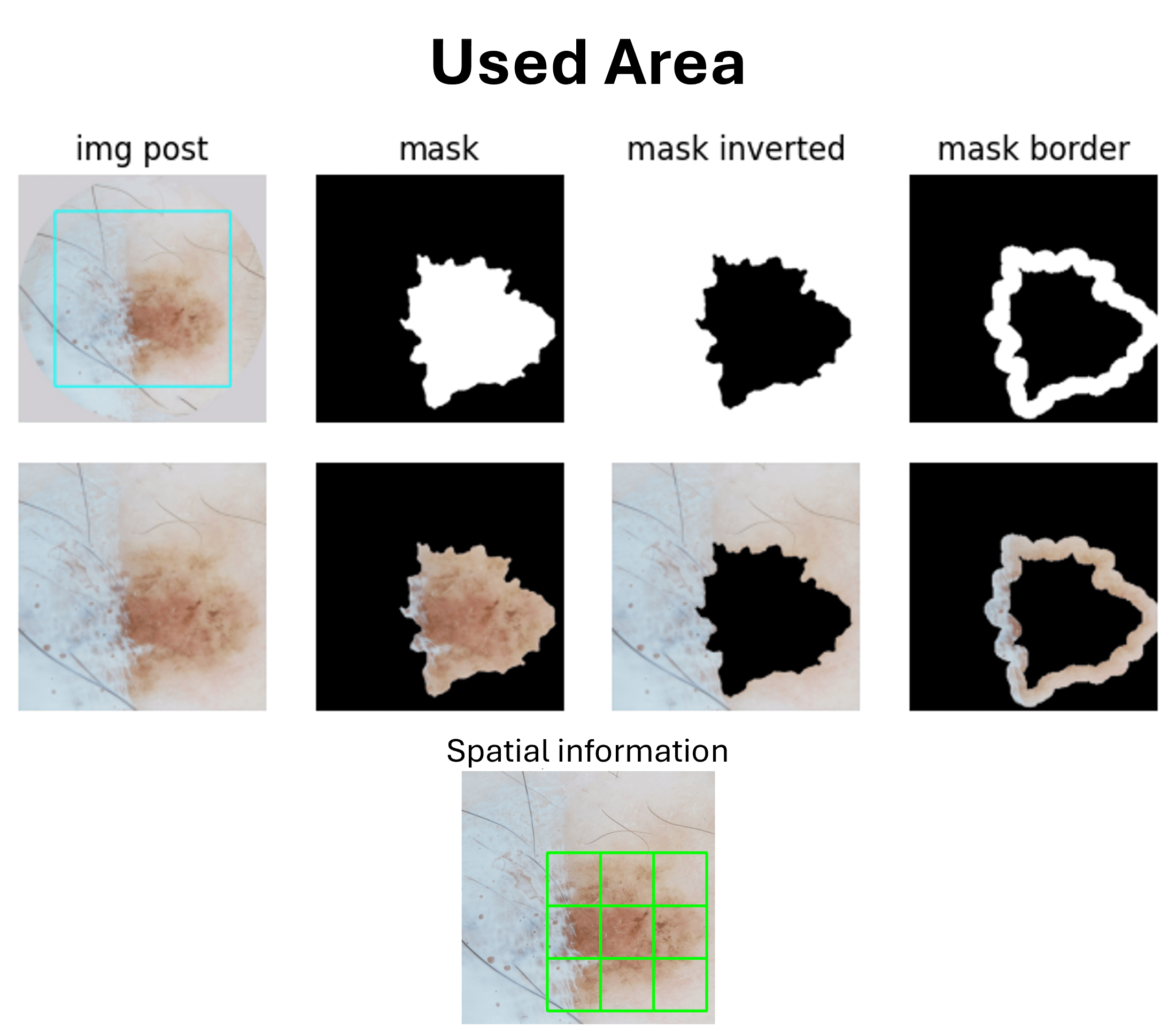 /projects/s3_skin_lesion_detection_ml/images/s3_skin_lesion_detection_ml_5.png