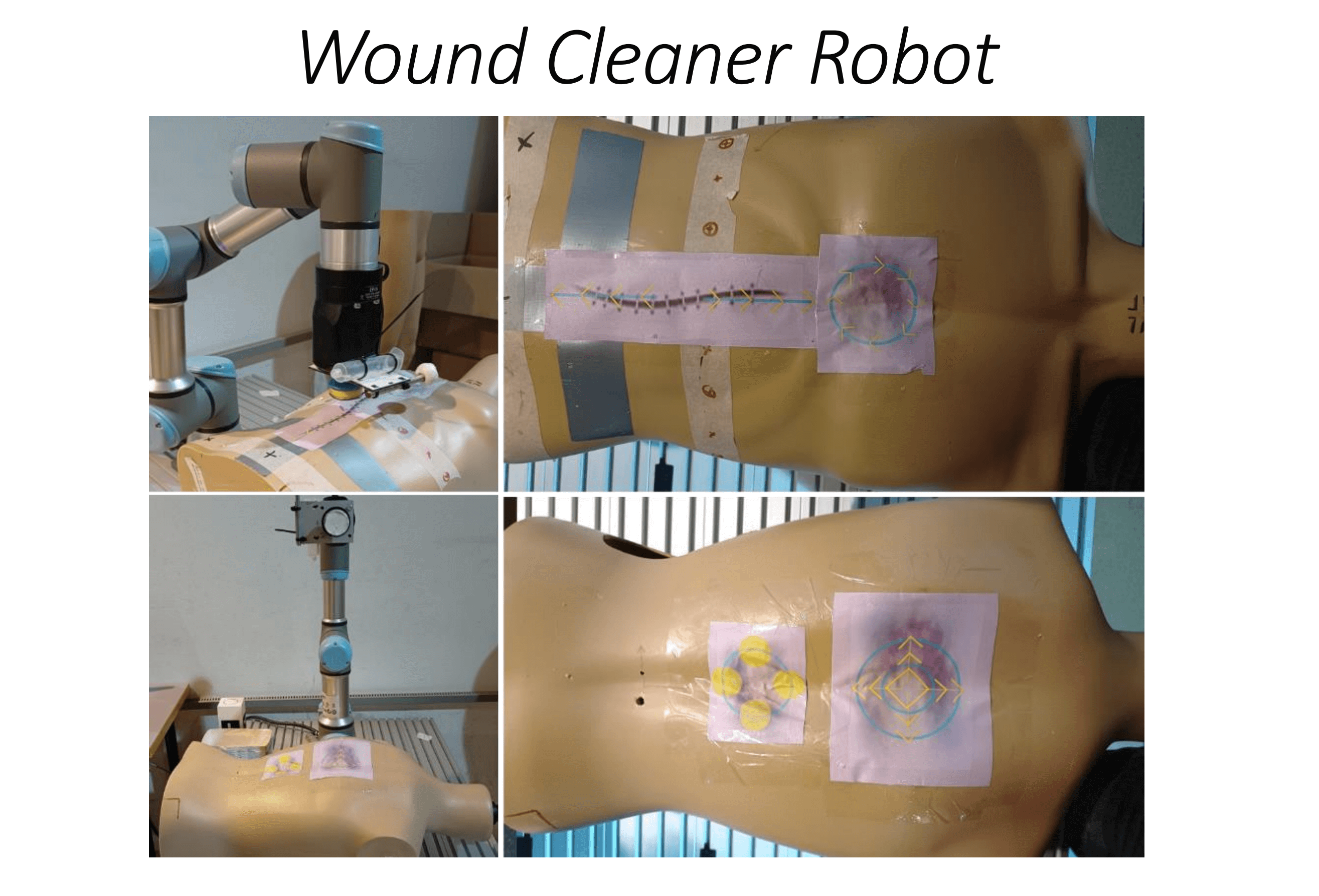 /projects/s3_wound_cleaning_robot/images/s3_wound_cleaning_robot_1.png