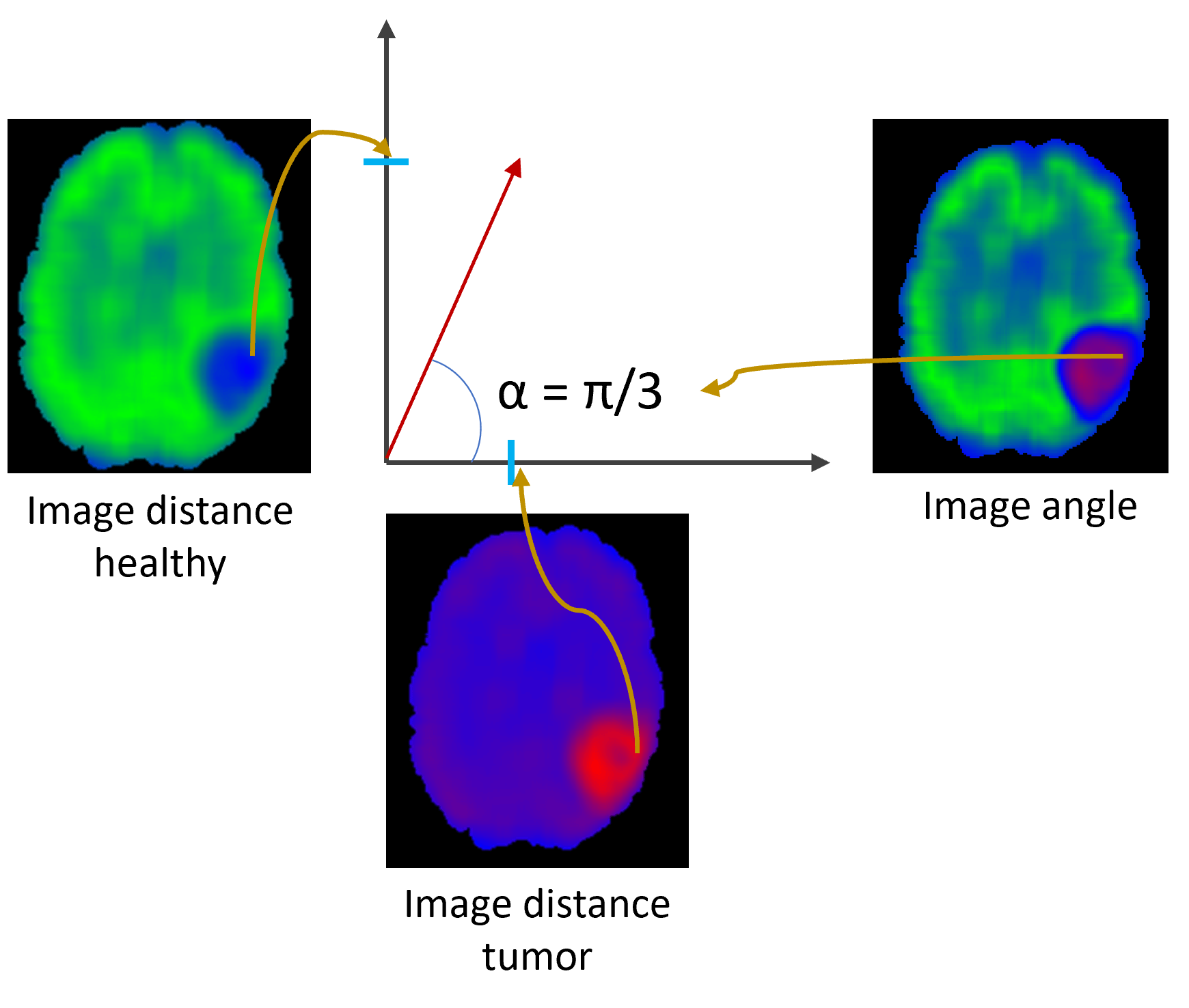 /projects/ub_brain_tumor_detection/images/ub_brain_tumor_detection_1.png