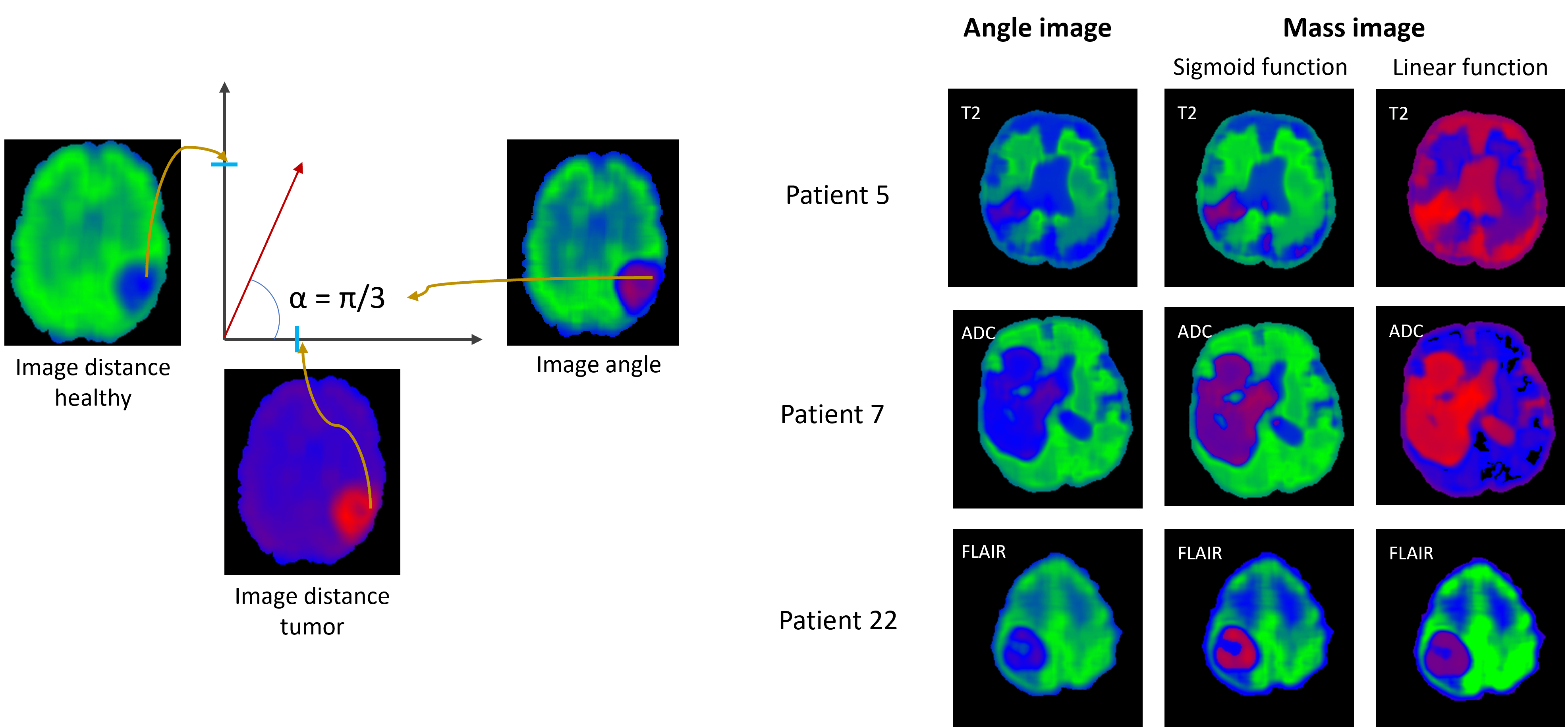 /projects/ub_brain_tumor_detection/images/ub_brain_tumor_detection_3.png